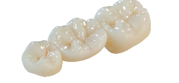 Couronne métallique