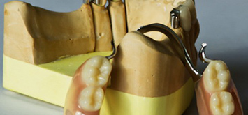 La prothèse composée