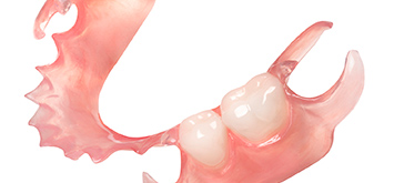 La prothèse TCS flexible 